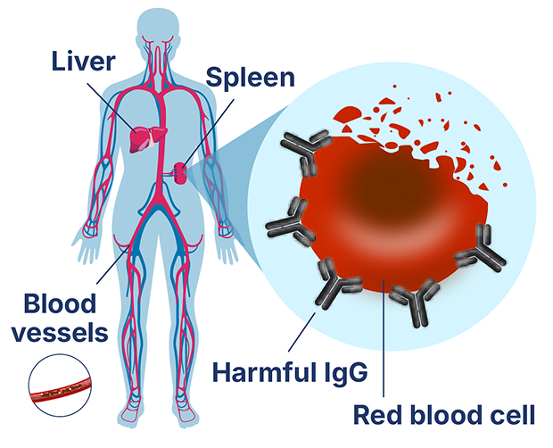 Diagram of red blood cells being broken down in the spleen